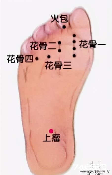 董氏奇穴治疗半身不遂中风后遗症的临床秘验