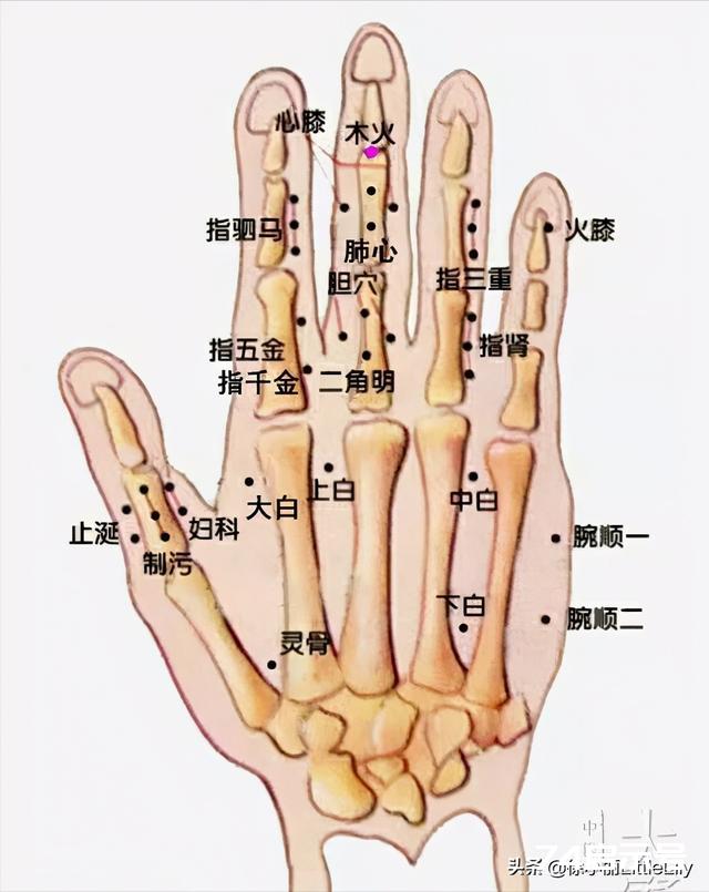 董氏奇穴治疗半身不遂中风后遗症的临床秘验