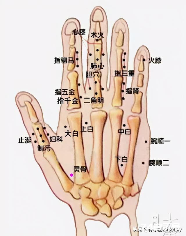 董氏奇穴治疗半身不遂中风后遗症的临床秘验