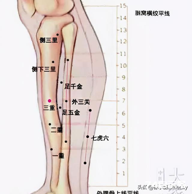 董氏奇穴治疗半身不遂中风后遗症的临床秘验