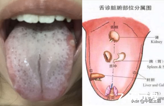 从舌头看健康：今天和大家分析四个典型的舌诊类型，每日舌诊分析