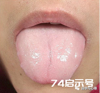 舌诊——望舌形诊病——老舌与嫩舌