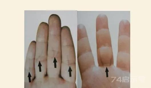 中医手诊诊疗法一、整体五根手指，对于五行。大拇指属土——脾胃；食指属金——肺、大肠，中指属火——心脑...