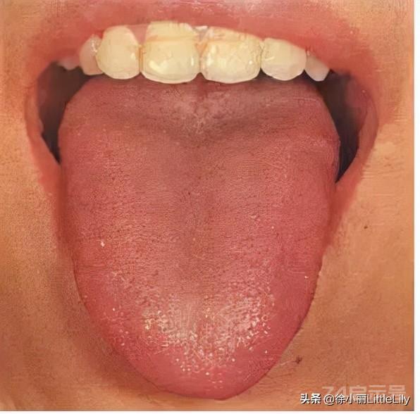 中医大师六十年舌诊经验总结