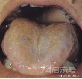 中医大师六十年舌诊经验总结