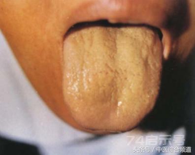传统中医《舌诊图谱大全》