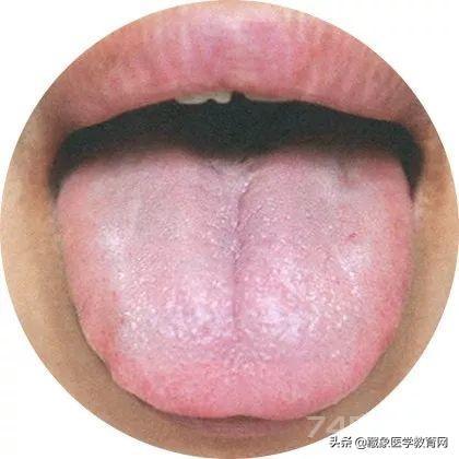 临床常见的120多种舌苔图谱（彩色超清），值得收藏