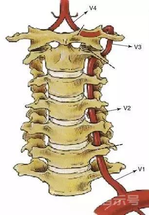 浅谈颈部解剖之“椎动脉”