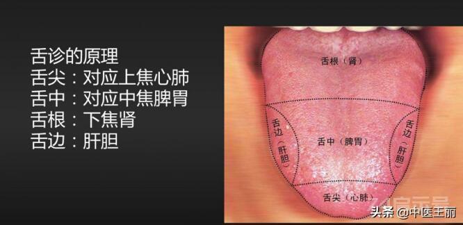 舌尖在最上方，就对应人的上焦，也就是心肺。舌头中部在中间，就对应人的中焦，也就是脾胃。舌头根部在下方...