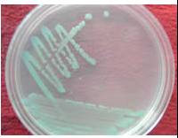 基础知识|几种微生物在不同培养基上的典型菌落形态（二）！