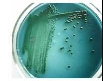 基础知识|几种微生物在不同培养基上的典型菌落形态（二）！