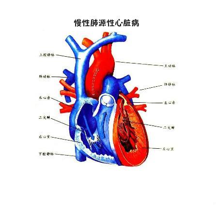 『心脏病集』中医治疗慢性肺源性心脏病特效秘方