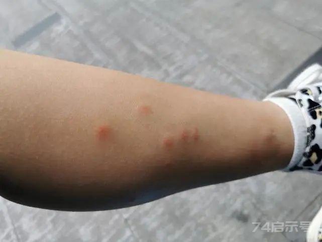 花蚊子是何方神圣，来中国不到50年，就已经成为中国的主流蚊子？