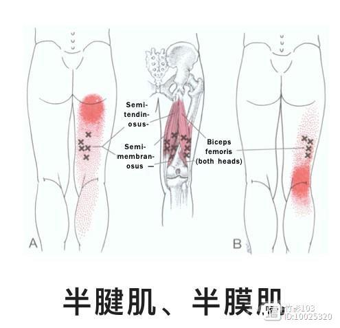 膝关节疼痛扳机点治疗1---膝关节后侧疼痛
