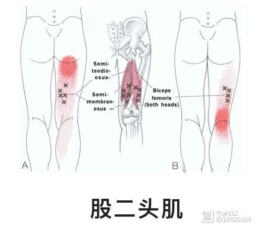 膝关节疼痛扳机点治疗1---膝关节后侧疼痛
