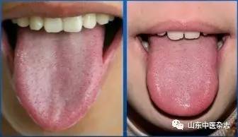 舌诊“液线”分析