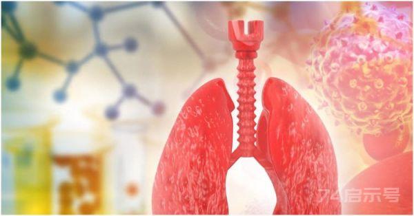肺开始“病变”时，多半会有两种异象，若没中，恭喜，肺还不赖