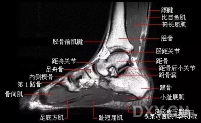 踝关节磁共振（MRI）解剖--精品图集
