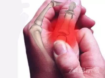骨科名医：手指疼痛，可能是这3个原因，越早看越好！