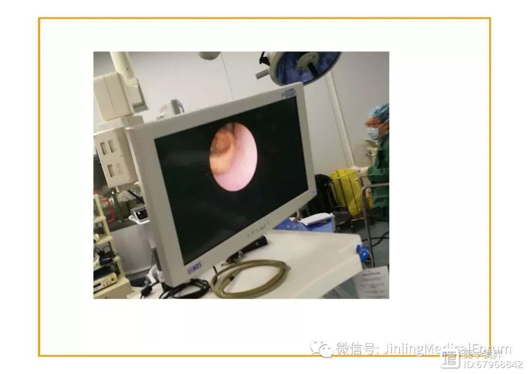 『吕建林』:硕通镜在尿结石治疗中的应用