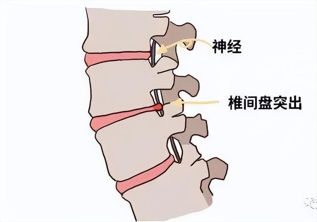 中药名方——上调颈椎、中调腰椎、下调膝盖、下治膝盖