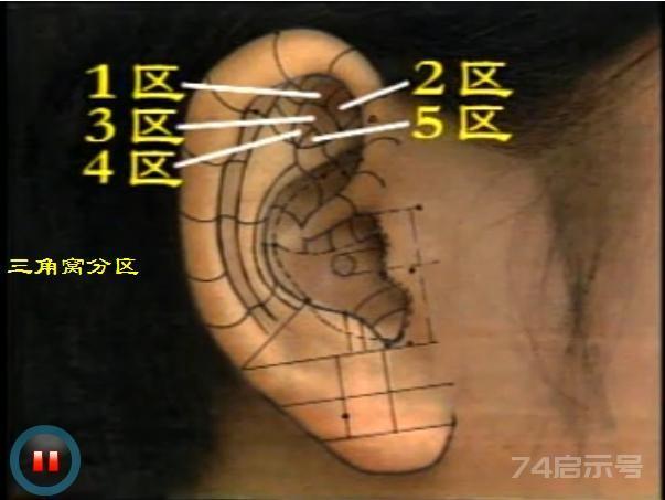 耳穴按摩三角窝 ——保养盆腔和内生殖器
