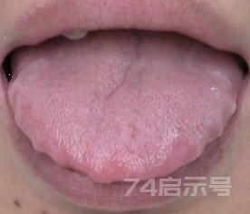 李芳祥讲中医诊断 舌诊内容（配图）
