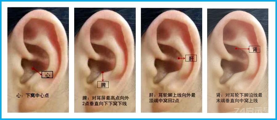 前列腺的耳穴疗法