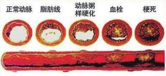 输液泵的使用_输液_输液提醒器输液宝