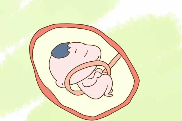 胎儿脐带绕颈_脐带绕颈宝宝_脐带绕颈部的胎儿