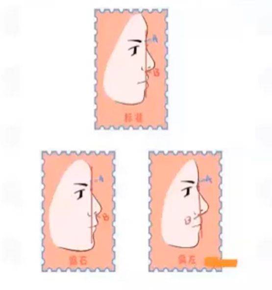 被骂又老又土的旺旺，到底是怎么变美的？