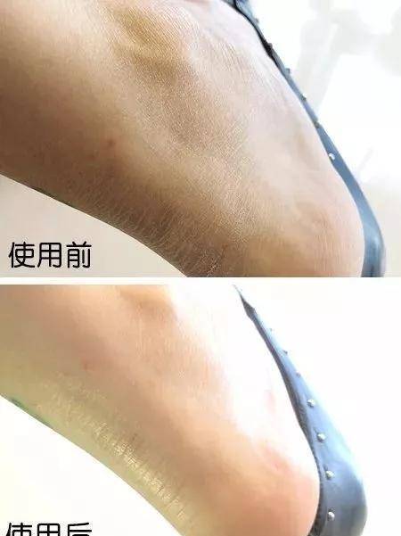 你见过赵丽颖的“巴掌脚”吗？网友：可以用“三寸金莲”来形容了