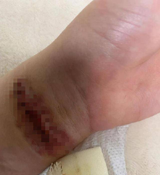 权珉娥深夜发文疑似又想轻生？