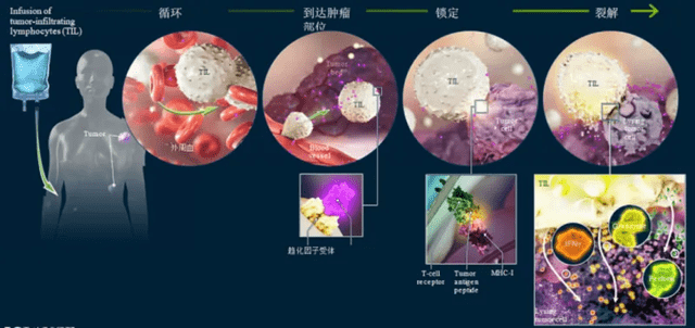 关于癌症免疫细胞治疗，你所需要了解的9个问题