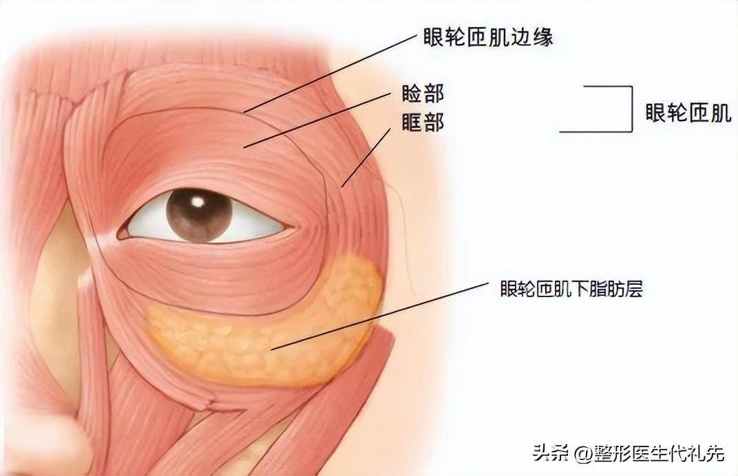 外切眼袋能保留卧蚕吗？出现了卧蚕消失应该怎么补救？