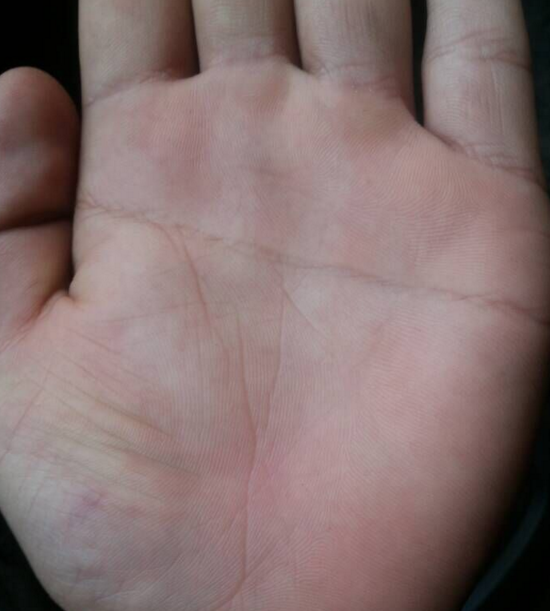 右手断掌纹_男右手断掌纹_男孩右手断掌纹