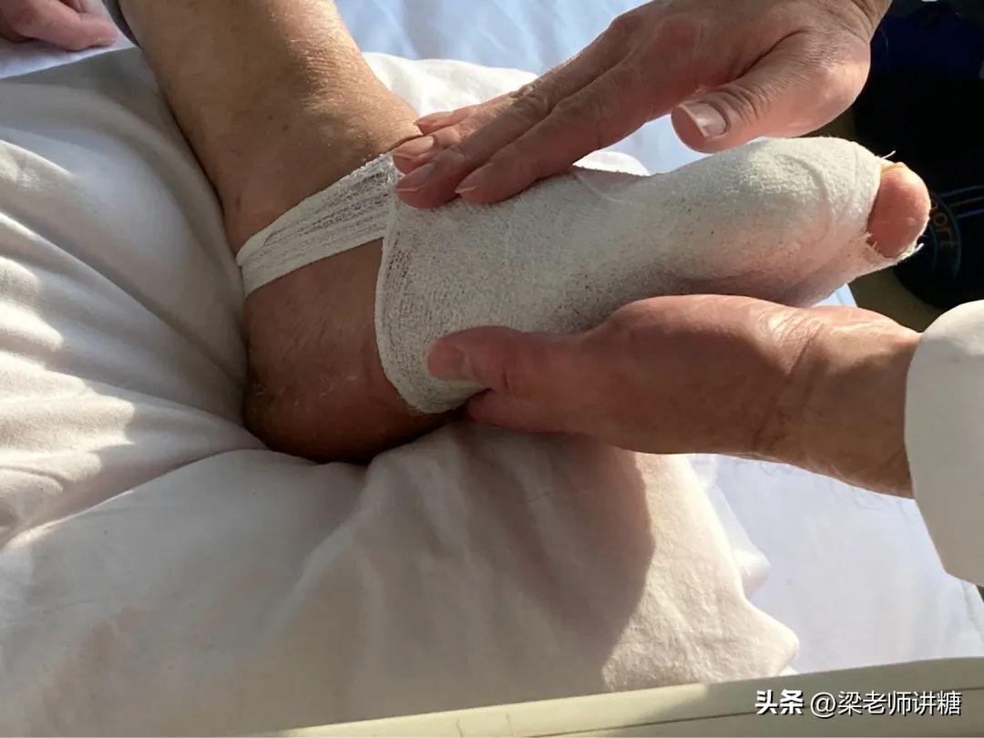 二期糖尿病_糖尿病人的饮食_糖尿病药