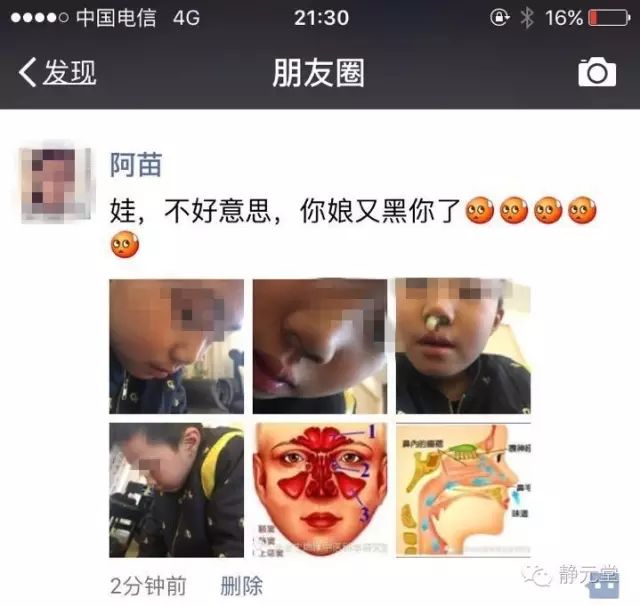 沈阳鼻炎治疗_治疗鼻炎_上海鼻炎治疗医院