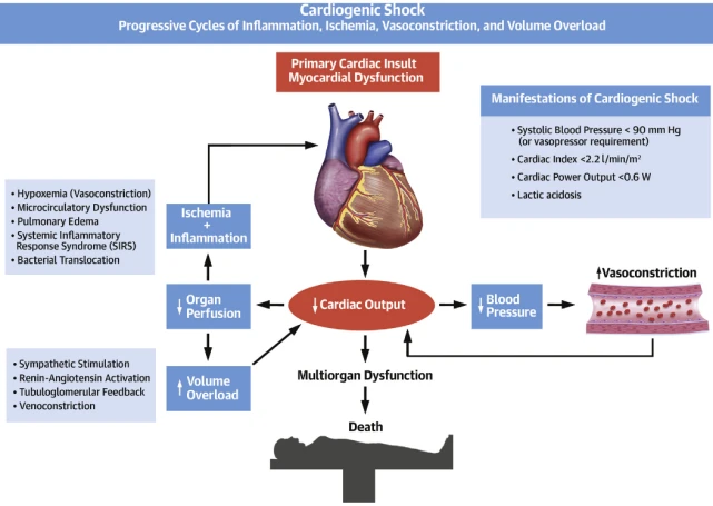 干货丨JACC子刊最新综述：心源性休克的标准化综合管理
