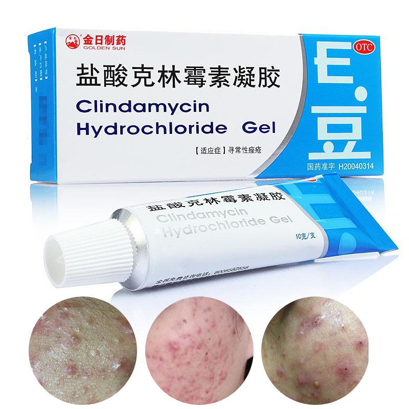孕妇治疗脚气的最佳方法_治疗灰指甲的最佳方法_暗疮的最佳治疗方法