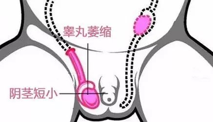 男性生殖生理学图集_男性生殖问题_男性生殖器大小