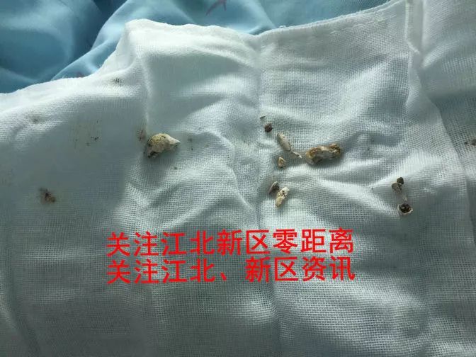 管胰腺的药_胰管_管胰腺炎的药