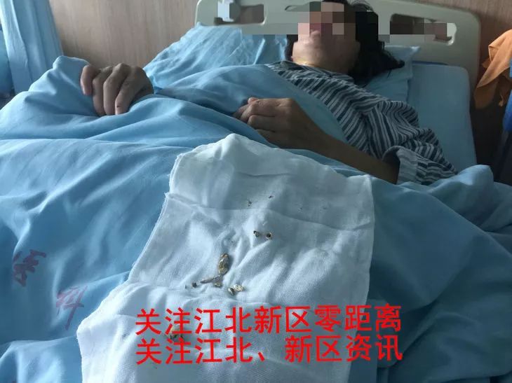 管胰腺炎的药_胰管_管胰腺的药