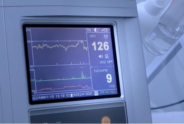 心跳多少次算正常？医生：中国、美国、欧洲执行标准都不一样