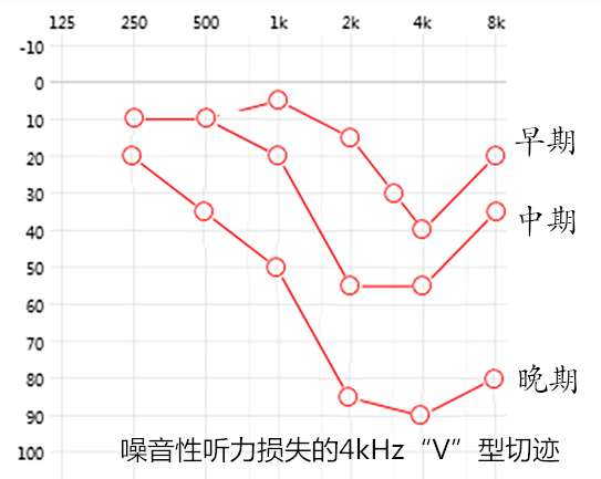 耳塞什么牌子隔音好_耳塞_3m耳塞零听耳塞