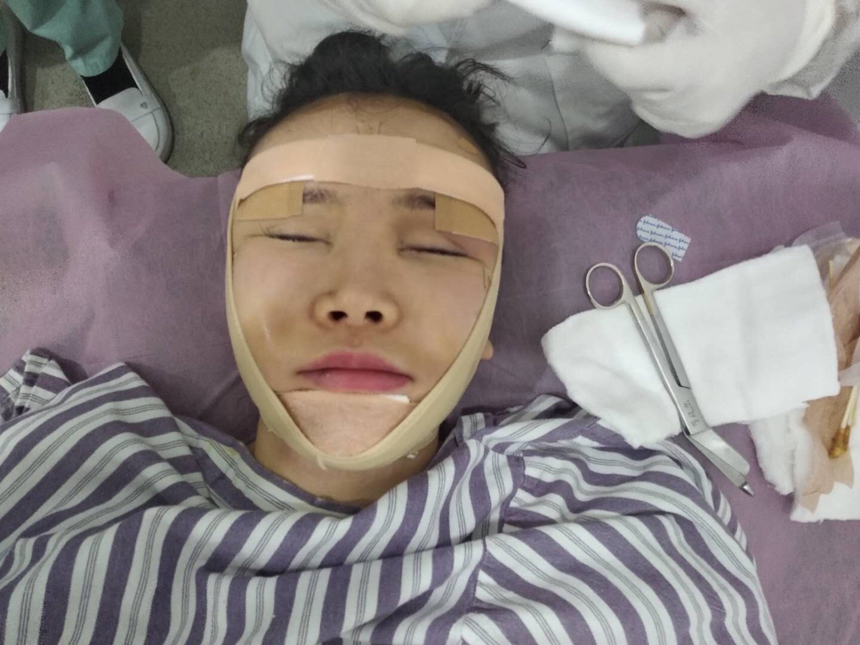 手心痒肿痒肿怎么回事_手和脚肿容易肿尤其热_最肿