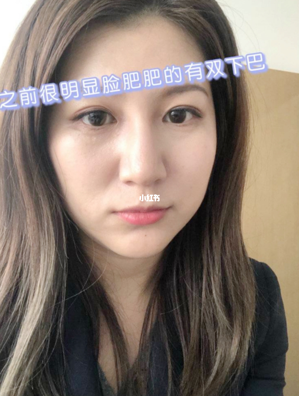 最肿_手和脚肿容易肿尤其热_手心痒肿痒肿怎么回事