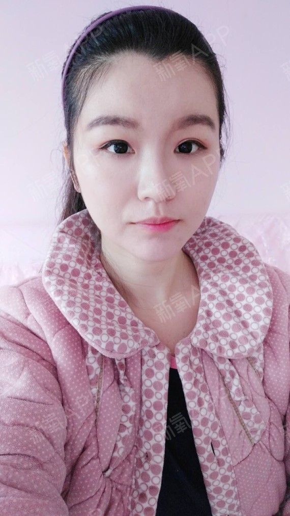 手和脚肿容易肿尤其热_最肿_手心痒肿痒肿怎么回事