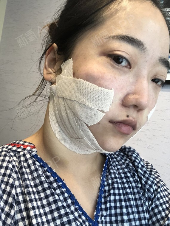 手和脚肿容易肿尤其热_最肿_手心痒肿痒肿怎么回事