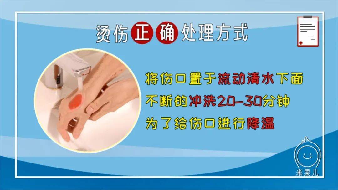 烫伤医院怎么治疗_烫伤医院_烫伤医院哪家好